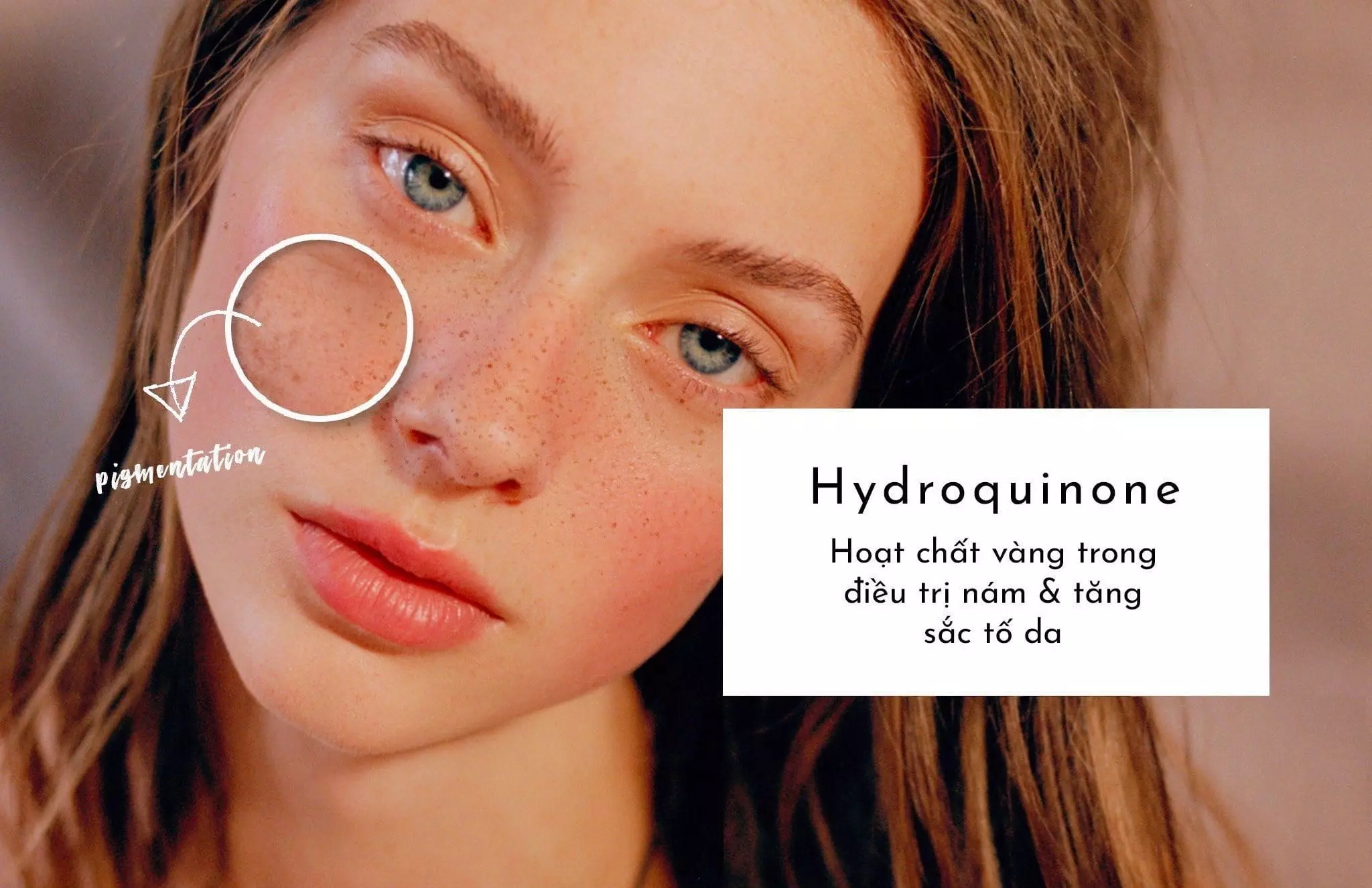 Chăm sóc da mặt trắng mịn với Hydroquinone