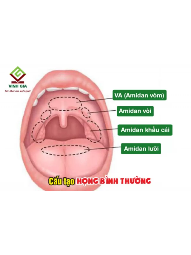   Hình ảnh viêm họng: Bạn đã từng thấy những khác biệt giữa họng bình thường và họng bị viêm chưa?